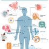 Blood-based highly sensitive diagnostics of multiple myeloma